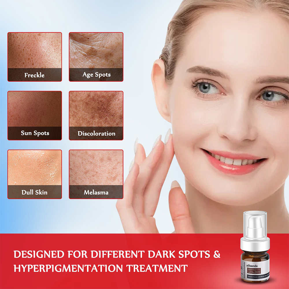 Younger, more effective, cheaper-alisanda young password alisanda Niacinamide Freckle Removal Essence /alisanda Anti-Aging Cream/Skin Care Combo Comfort