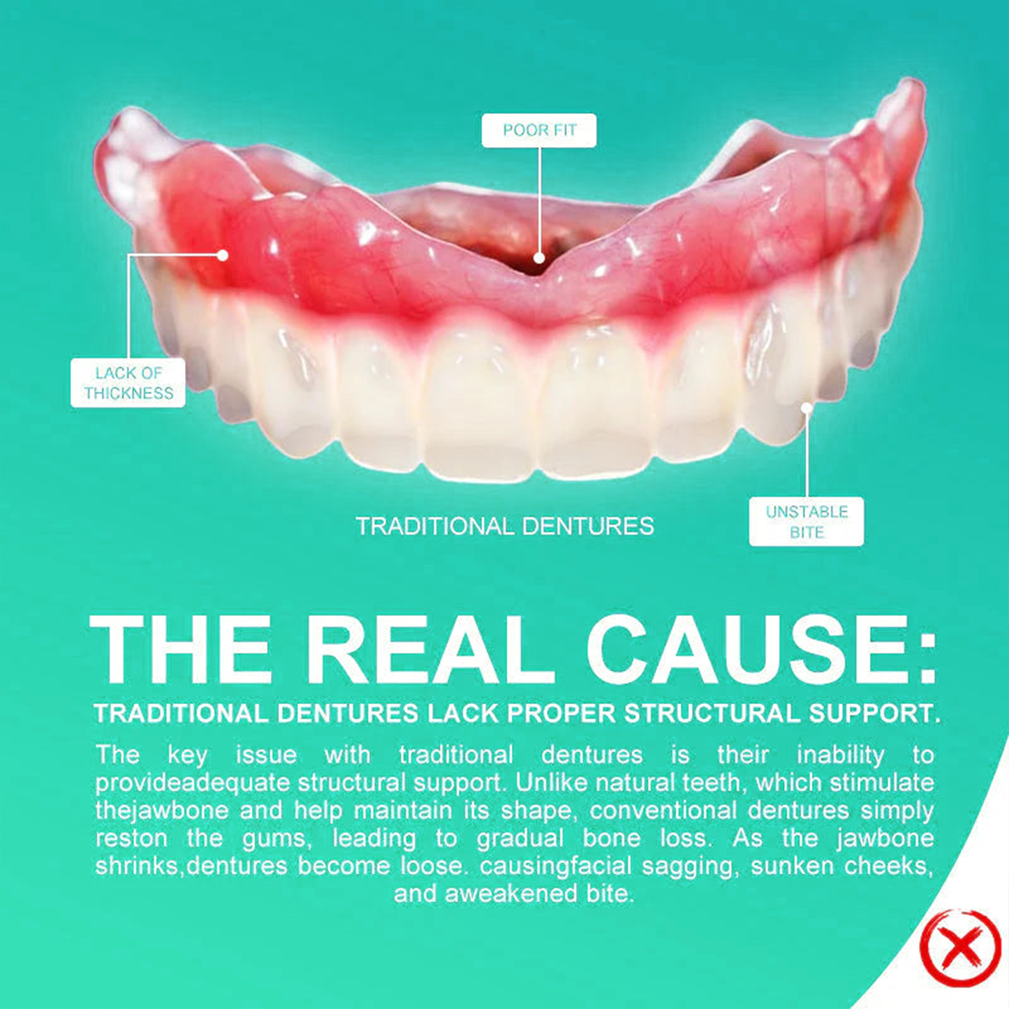 ✅ Made and Shipped from the UK| Skavix™ Suction-fit Complete Denture 🍀