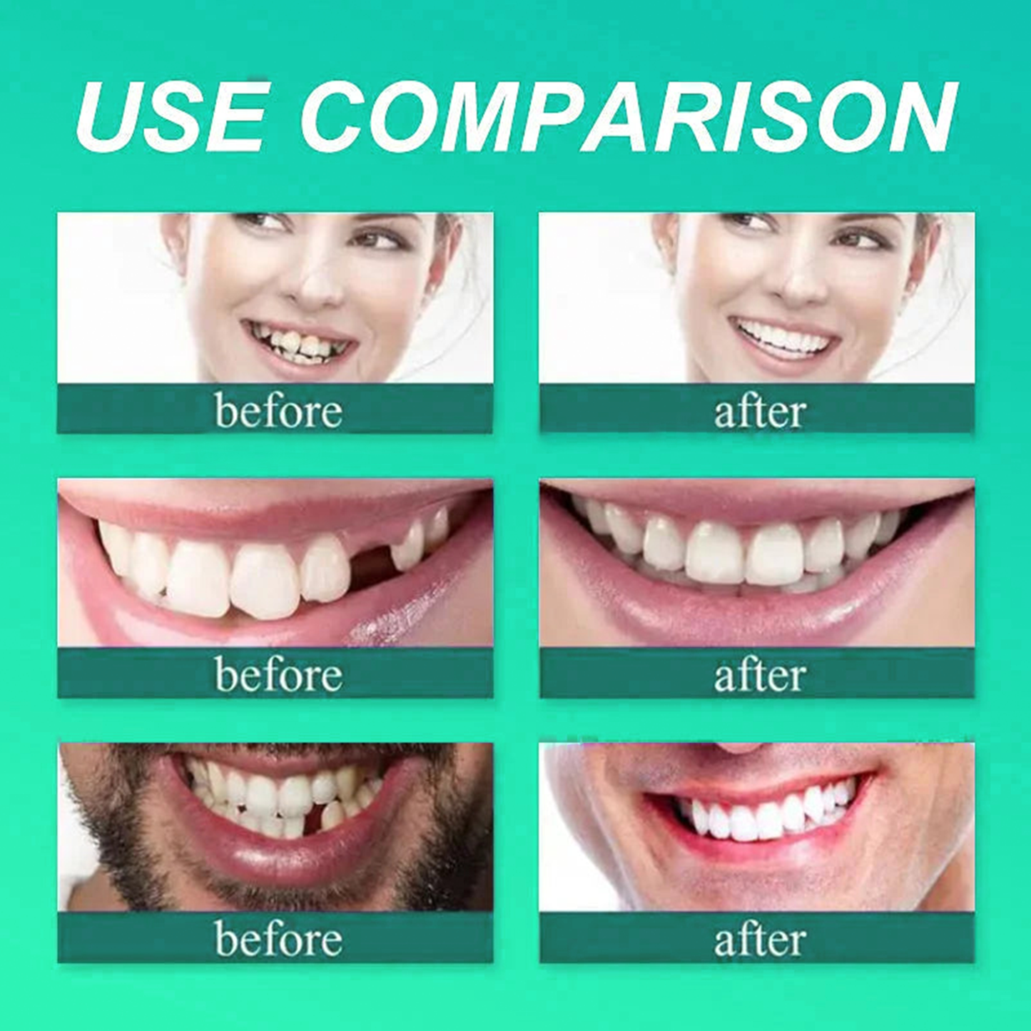 ✅ Made and Shipped from the UK| Skavix™ Suction-fit Complete Denture 🍀