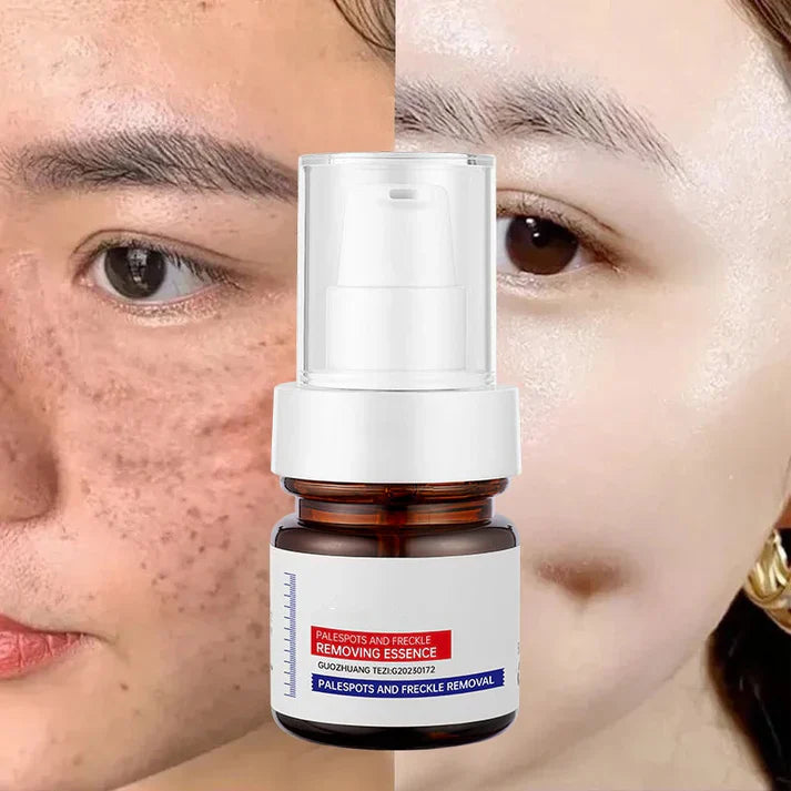 Younger, more effective, cheaper-alisanda young password alisanda Niacinamide Freckle Removal Essence /alisanda Anti-Aging Cream/Skin Care Combo Comfort