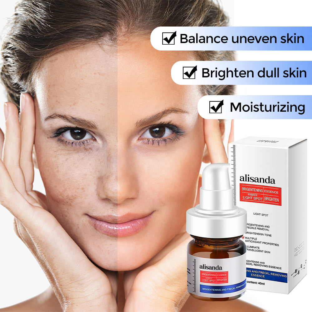 Younger, more effective, cheaper-alisanda young password alisanda Niacinamide Freckle Removal Essence /alisanda Anti-Aging Cream/Skin Care Combo Comfort