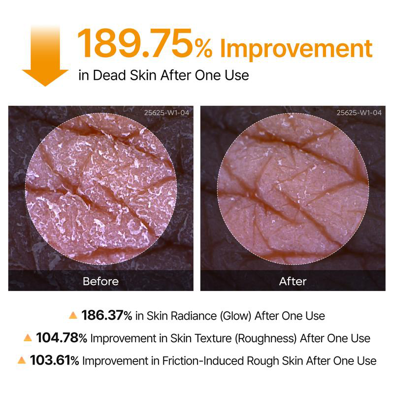 Keratin Care Kojic Acid Turmeric Spray 200ml