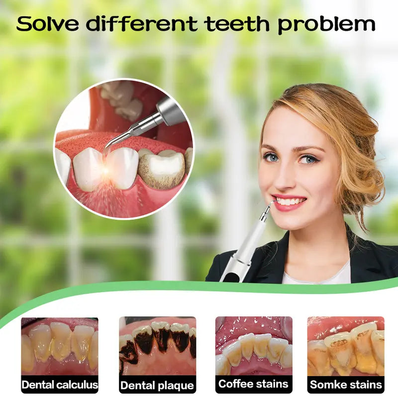AQA Plaque/Tartar Remover for Teeth, With LED lights and 5 adjustable modes,Rechargeable