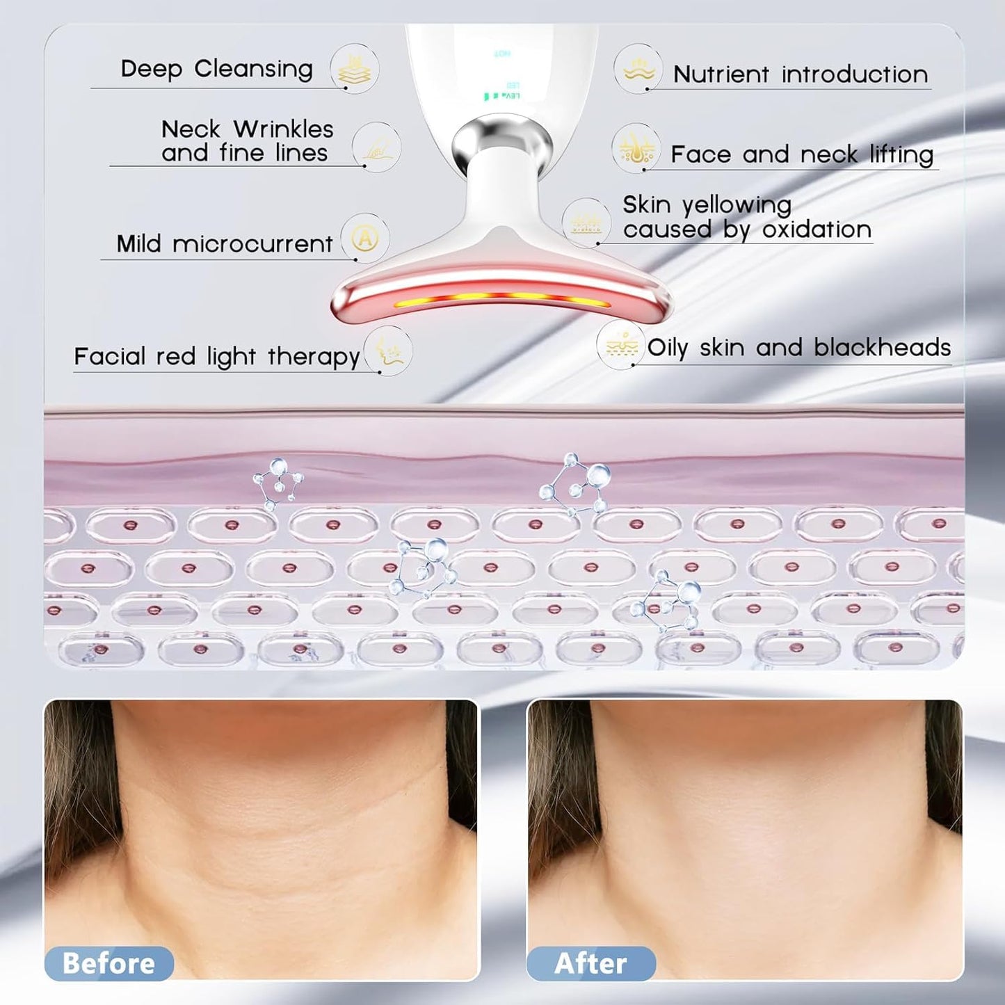 2025 AQA RF Face & Neck Massager with 7-Color LED – Skin Rejuvenation, Lifting, Toning & Glow Boost