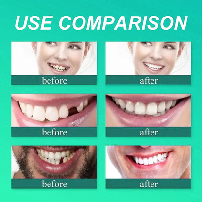 ✅ Made and Shipped from the UK| Skavix™ Suction-fit Complete Denture 🍀