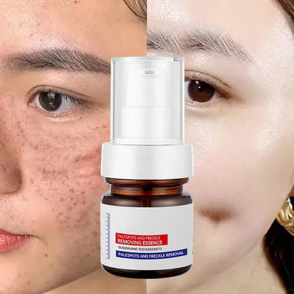 Younger, more effective, cheaper-alisanda young password alisanda Niacinamide Freckle Removal Essence /alisanda Anti-Aging Cream/Skin Care Combo Comfort