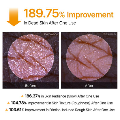Keratin Care Kojic Acid Turmeric Spray 200ml