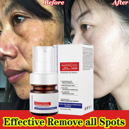Younger, more effective, cheaper-alisanda young password alisanda Niacinamide Freckle Removal Essence /alisanda Anti-Aging Cream/Skin Care Combo Comfort