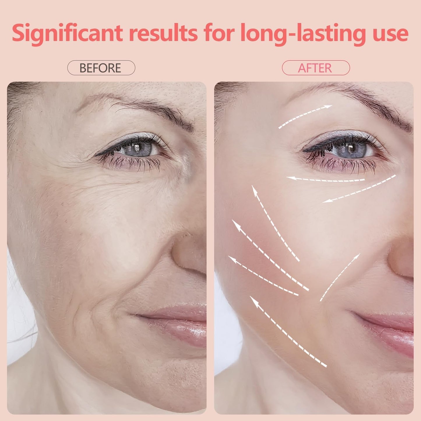 2025 AQA RF Face & Neck Massager with 7-Color LED – Skin Rejuvenation, Lifting, Toning & Glow Boost